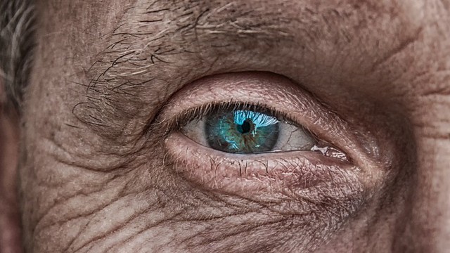 Galucoom een sluipende oogziekte, bijna 400.000 Nederlanders hebben het, helft weet het niet